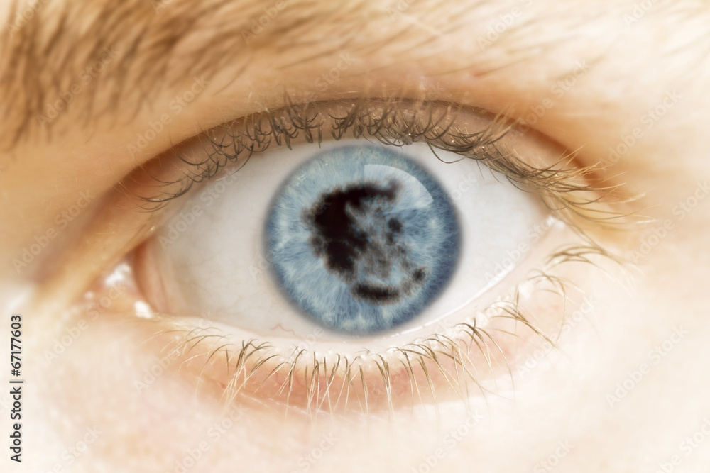Close-up of an eye with the pupil in the shape of Greece.(series Close-up of an eye with the pupil in the shape of Greece.(series