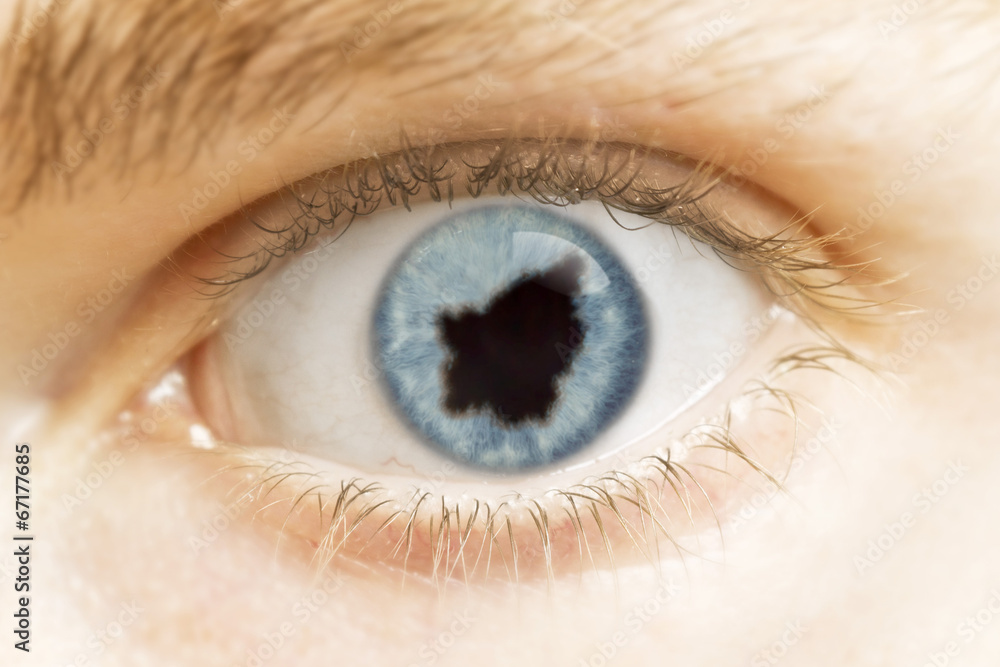 Close-up of an eye with the pupil in the shape of San Marino.(se Close-up of an eye with the pupil in the shape of San Marino.(se