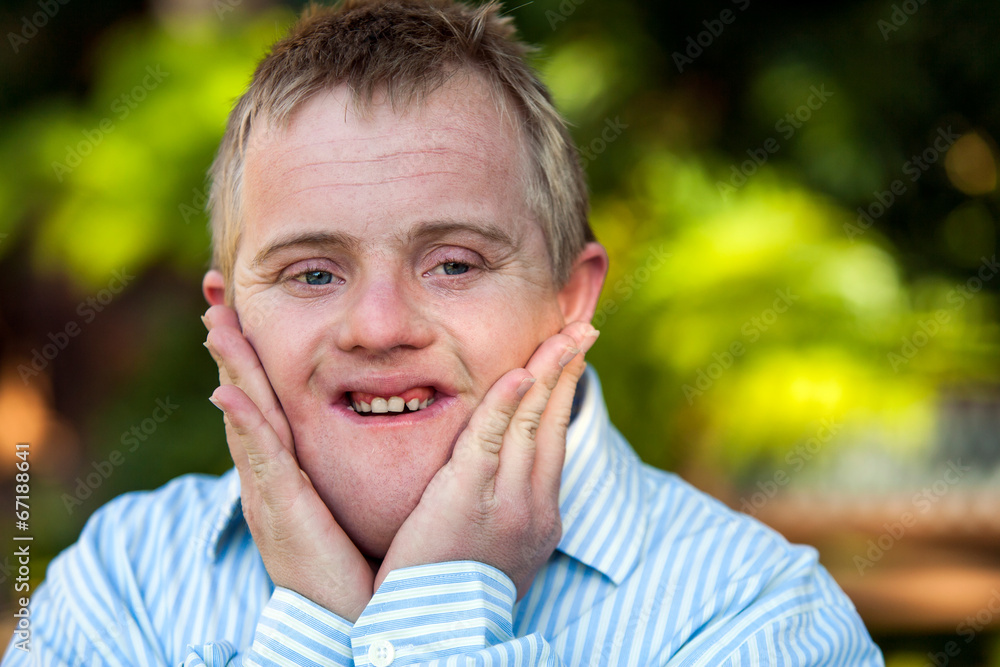 Handicapped boy with hands on face. Handicapped boy with hands on face.