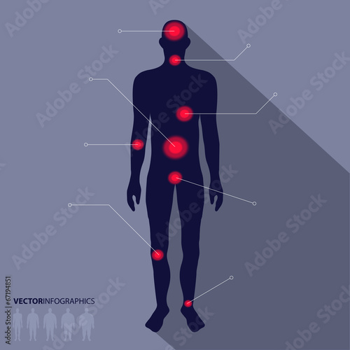 Man silhouette, pain point. Vector medical infographics