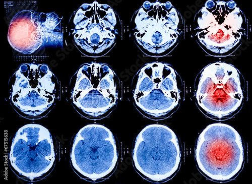 Obraz na płótnie X-Ray scan human for brain w salonie