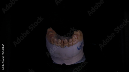 Dental 3D scanner photo