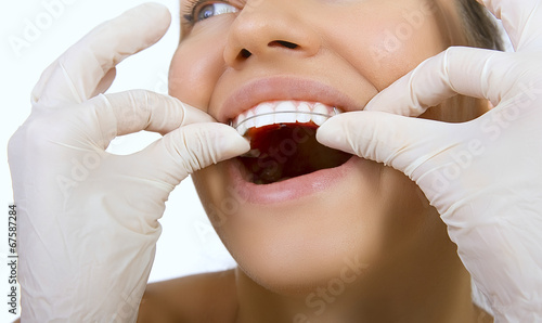 orthodontic doctor examine teeth and gums of jaw, retainer for t photo