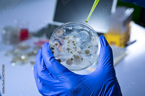 Cultured Microbes in Petri Dish photo