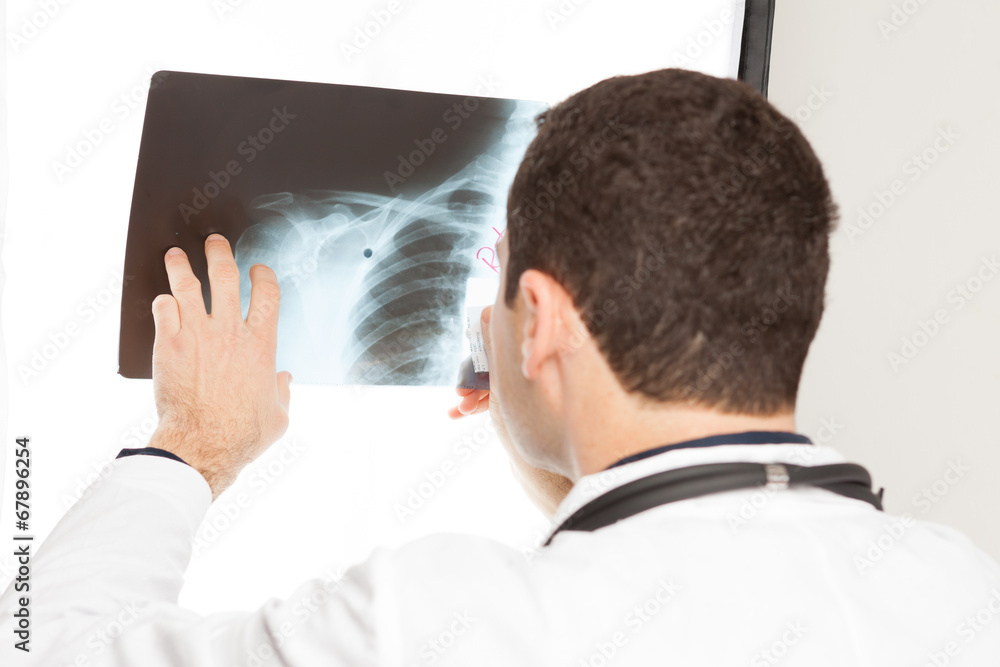 doctor holds X-ray doctor holds X-ray