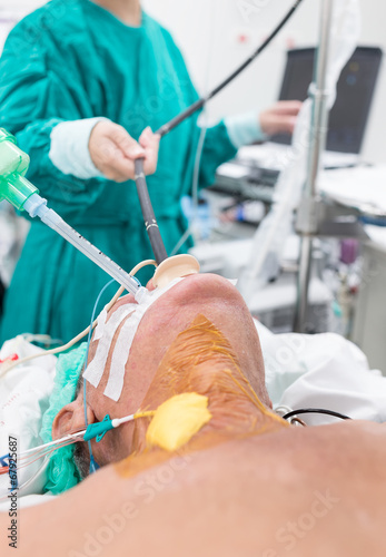 intraoperative transesophageal echocardiography for open heart s
