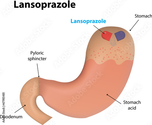 Lansoprazole photo