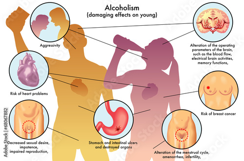 alcolismo giovanile