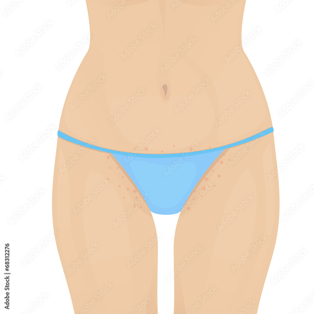 hair removal hair removal
