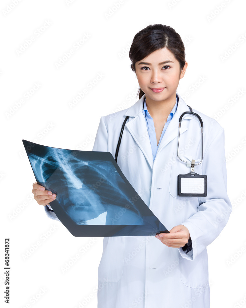 Medical female doctor with x ray film of chest lung Medical female doctor with x ray film of chest lung