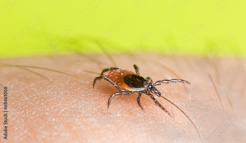 Castor bean tick, Ixodes ricinus crawling on human skin Castor bean tick, Ixodes ricinus crawling on human skin