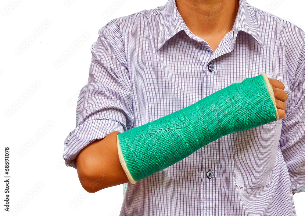 Broken Shoulder Cast