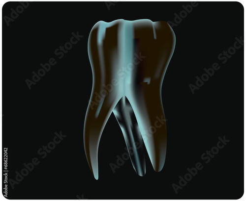 X-ray of the tooth