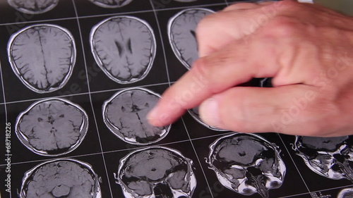 Arzt überprüft MRI Aufnahmen