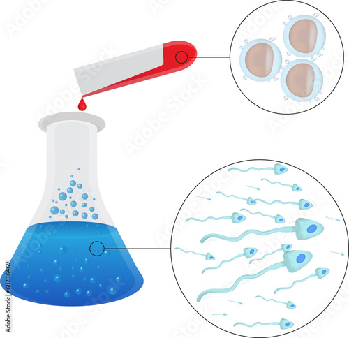 In Vitro Fertilisation Diagram