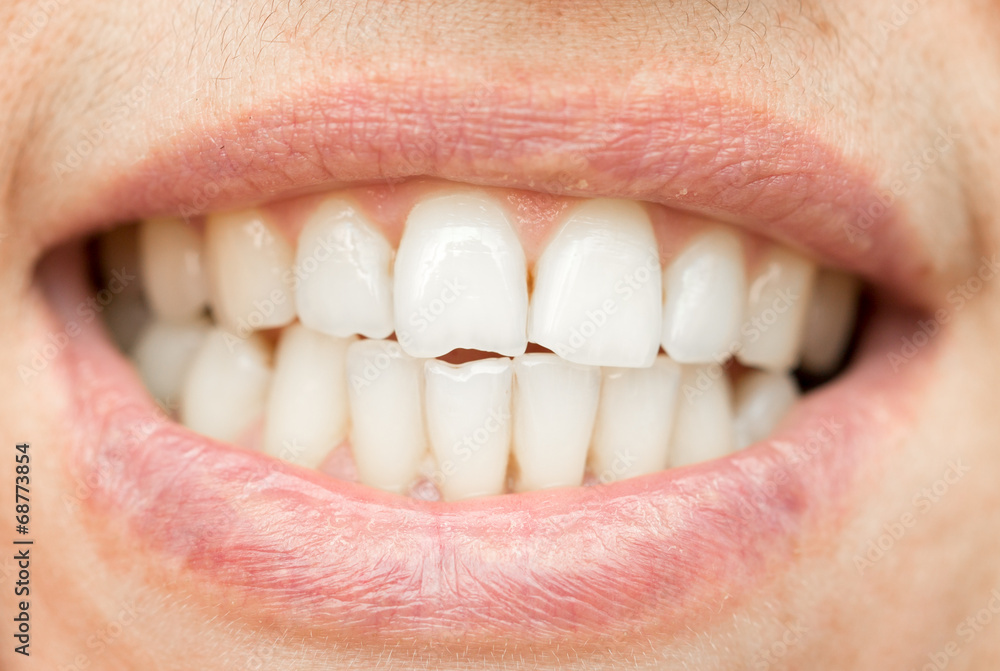 Obraz premium teeth. close-up