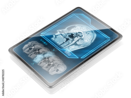 Tablet with MRI scan isolated on white background