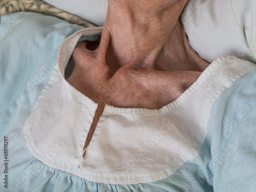 Canvastavla Very skinny old woman lying in a bed