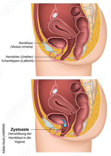 Zystozele, Anatomie der Harnblase