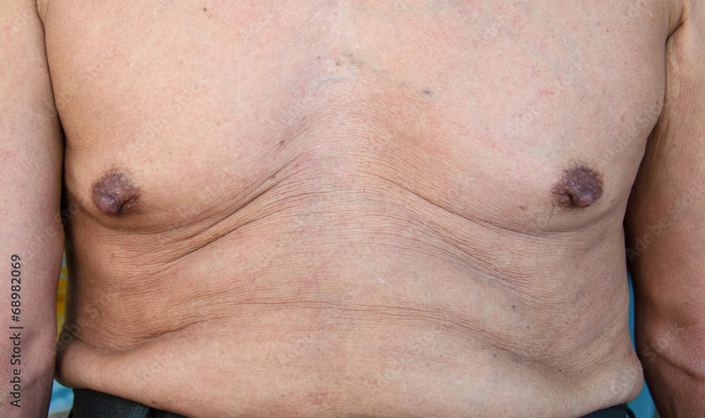 Naklejka premium elderly man with a cellulite on a stomach