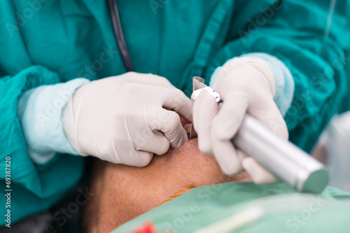 apply laryngoscope blade for insert endotracheal tube