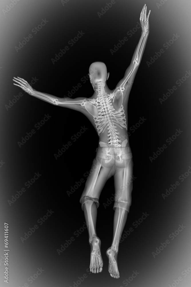 human bones radiography scan image human bones radiography scan image