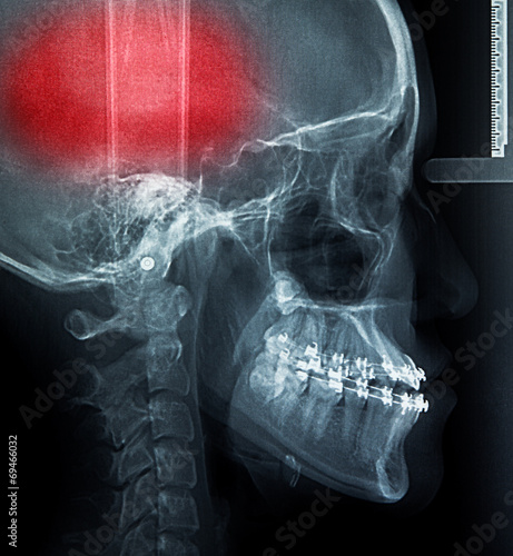 Obraz na płótnie X-Ray scan human w salonie
