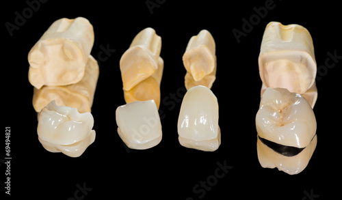 Obraz na plátně Dental ceramic crowns