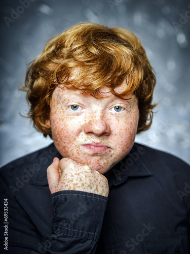 Obraz na płótnie Fat freckled boy portrait