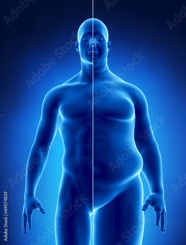 Obesity concept in x-ray