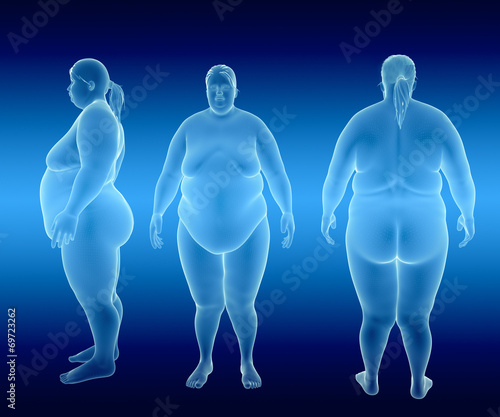 Overweight Female