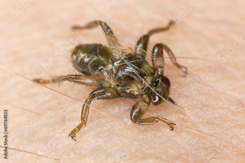 Deer fly, Lipoptena cervi crawling on human skin photo