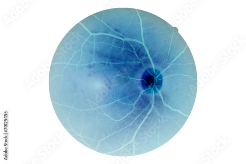 Human eye anatomy, retina, optic disc artery and vein etc. photo