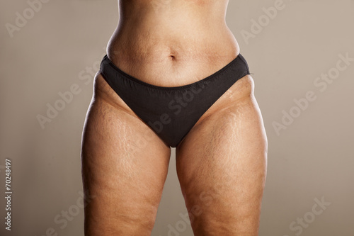 hips of a very thick woman in black panties