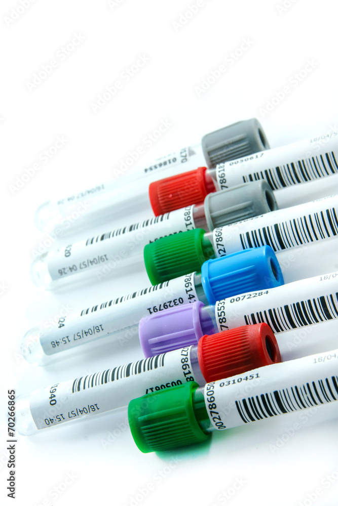 Medical test tubes with blood in laboratory Medical test tubes with blood in laboratory