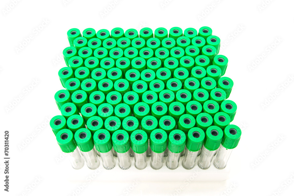 medical blood tube collection for laboratory medical blood tube collection for laboratory