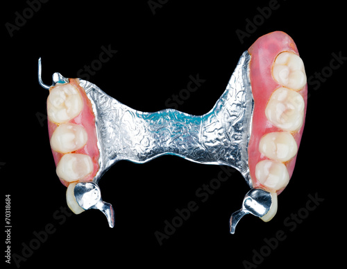 Fotografie Removable dental prosthesis