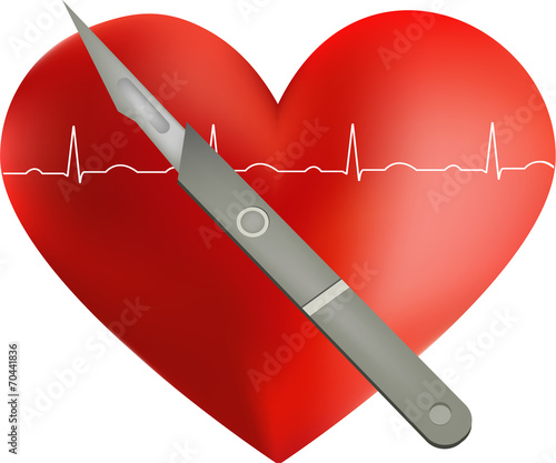 Heart Surgery