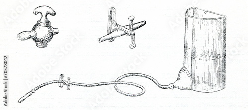 Tableau sur toile Old enema equipment (Esmarch cup)