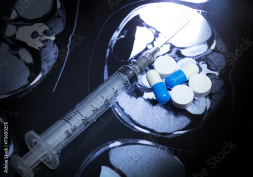 Syringe and medicine on CT-scan film
