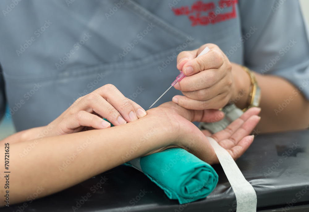 Fototapeta premium open radial artery for arterial line monitor