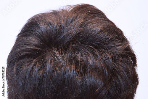 30代男性の髪の接写