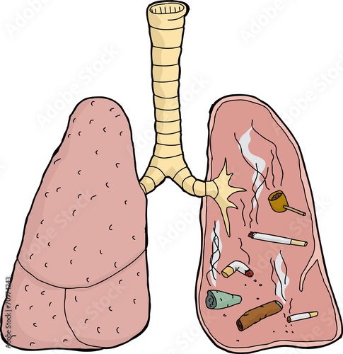 Isolated Dirty Lungs