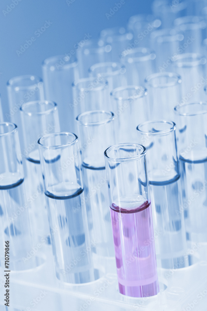 Test tubes with liquid on blue background Test tubes with liquid on blue background