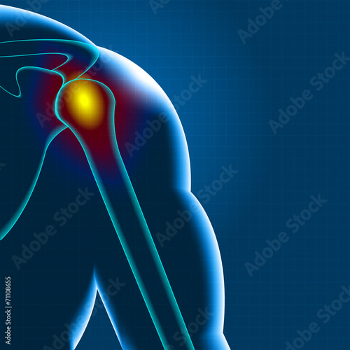 Shoulder pain
