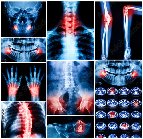 Obraz na płótnie Collage of human X-rays photo w salonie