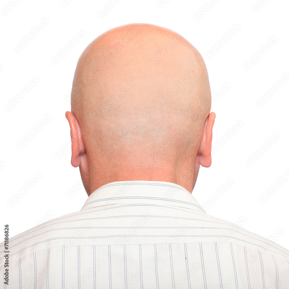 Fototapeta premium Hairless head with space for your text.