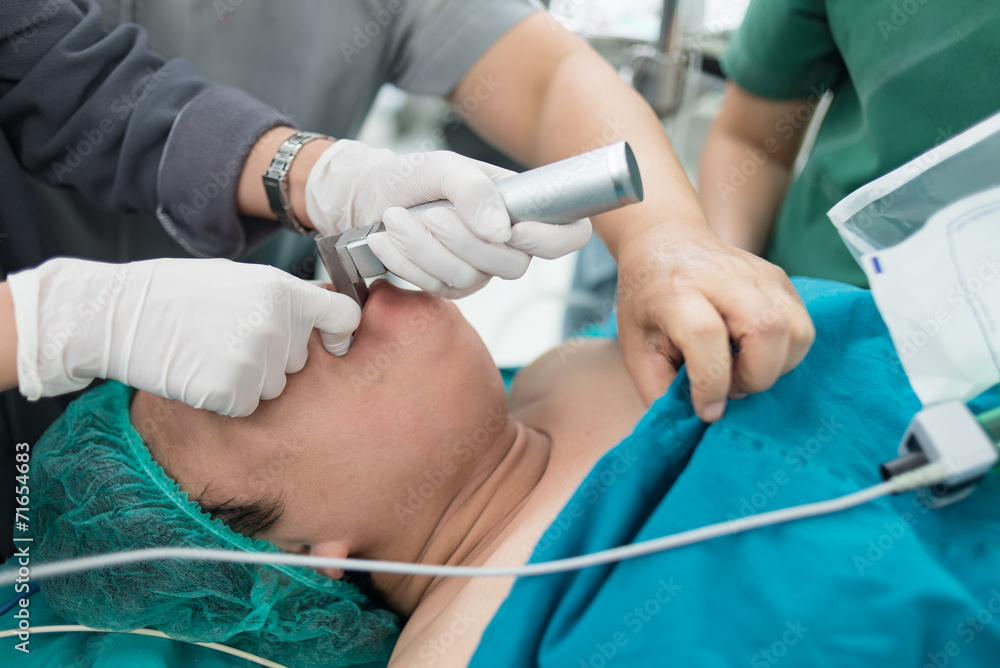 apply laryngoscope for insert endotracheal tube apply laryngoscope for insert endotracheal tube