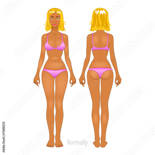 Fat and thin woman, vector illustration, normal, anorexia body