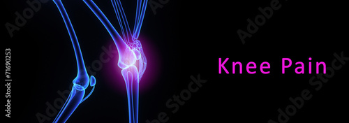 knee pain